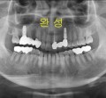 파노-완성